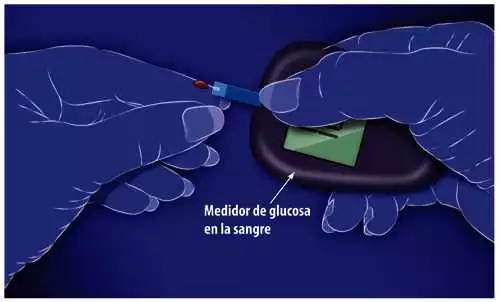 Insulinorm en La Junquera: regulando los niveles de azúcar en sangre de forma natural – Farmacia La Junquera