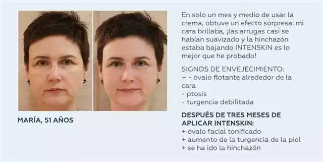 Precio de Intenskin en Málaga – Encuentra la mejor oferta en tratamientos de belleza
