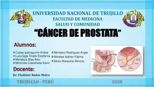 Prostaktiv en la farmacia de Valladolid: prevención y tratamiento del cáncer de próstata