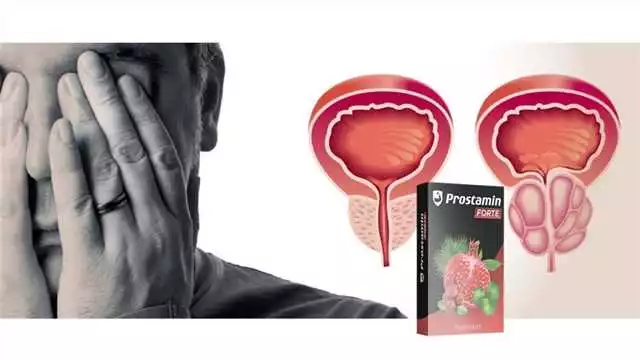 Prostamin en Garza: La solución natural para la salud de la próstata